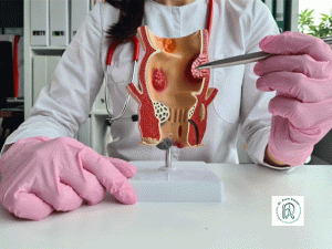 ایا-هموروئید-باعث-سرطان-می-شود؟