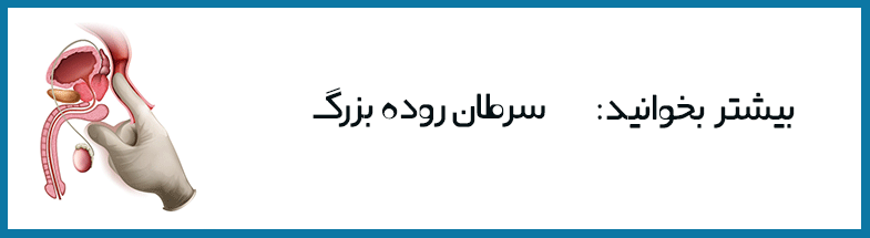 پیشگیری از پولیپ رکتوم پیشگیری از پولیپ رکتوم